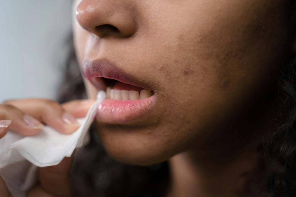 Cold Sore Tablets & Creams