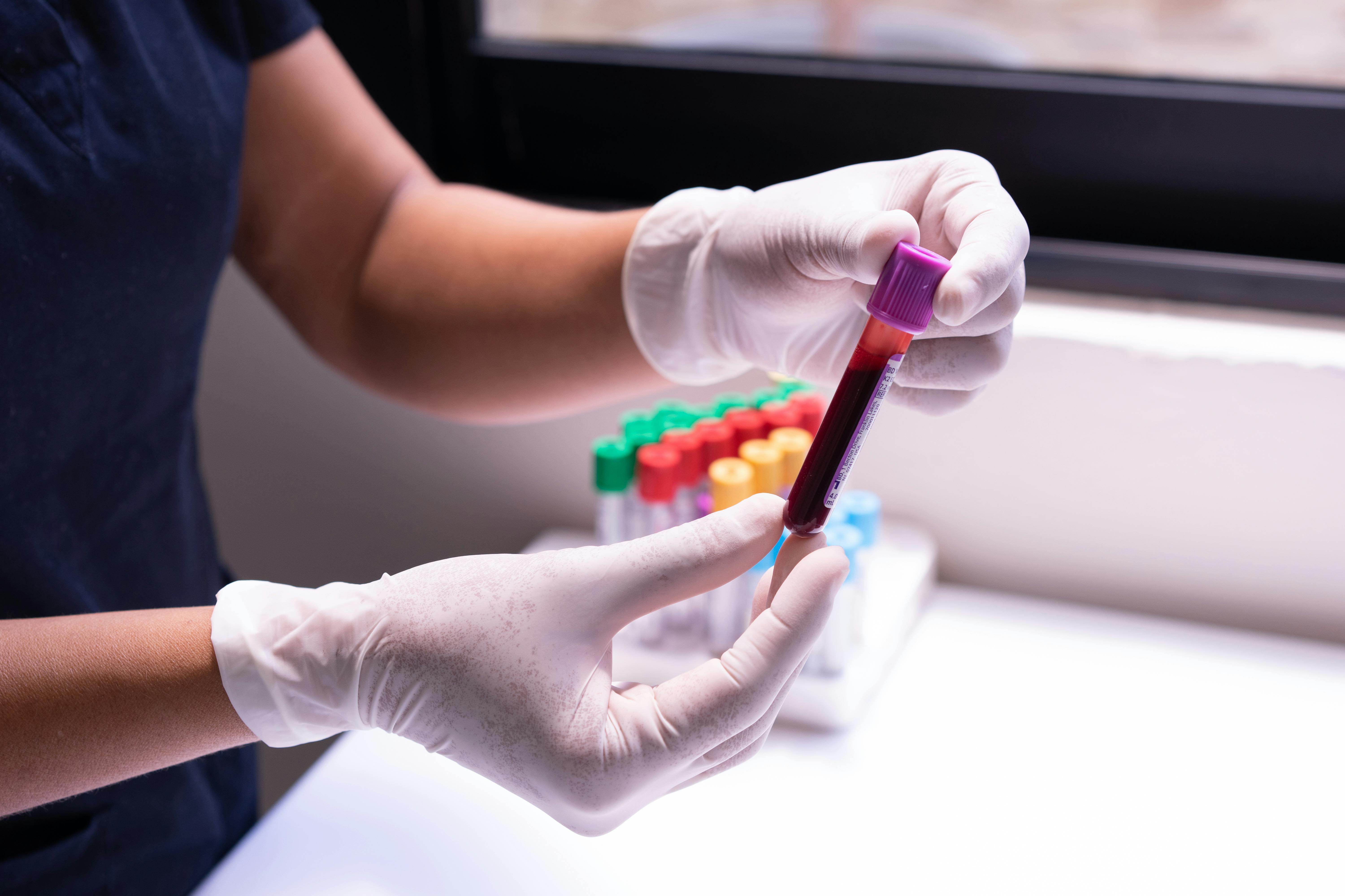 Home Blood Tests & Blood Testing Services