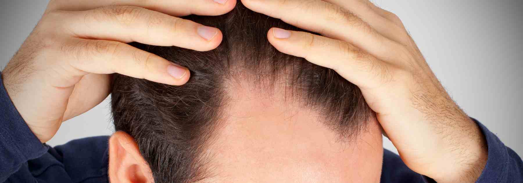 Explore shampoo for hair loss. 